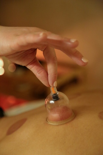 Massage décontracturant avec ventouses sèches